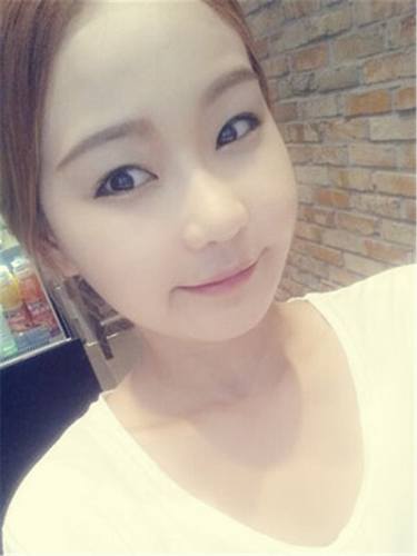 脂肪填充面部,让我再次体验了蜕变的感觉有多美妙!!!想要变美的女生看过来,给你们分享我的变美经历啦~~~~