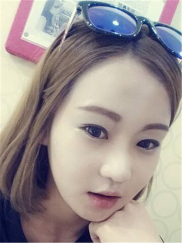 脂肪填充面部,让我再次体验了蜕变的感觉有多美妙!!!想要变美的女生看过来,给你们分享我的变美经历啦~~~~