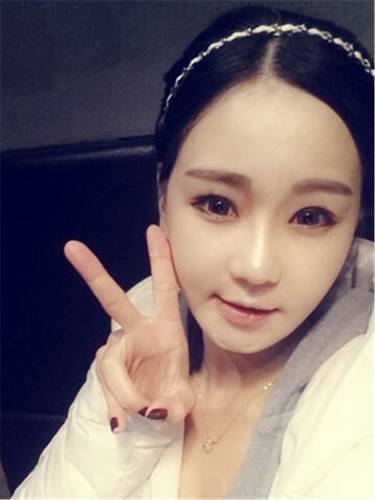 脂肪填充面部,让我再次体验了蜕变的感觉有多美妙!!!想要变美的女生看过来,给你们分享我的变美经历啦~~~~