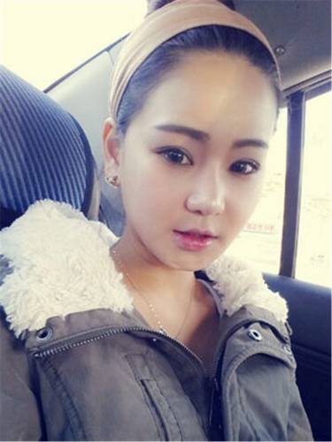 脂肪填充面部,让我再次体验了蜕变的感觉有多美妙!!!想要变美的女生看过来,给你们分享我的变美经历啦~~~~