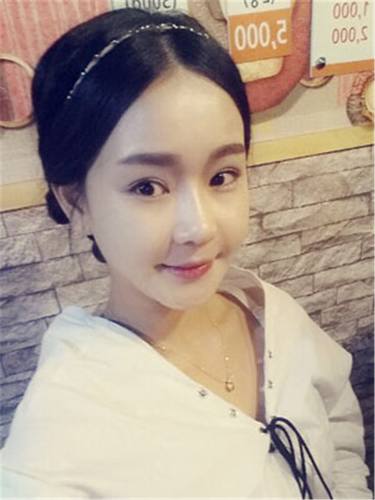 脂肪填充面部,让我再次体验了蜕变的感觉有多美妙!!!想要变美的女生看过来,给你们分享我的变美经历啦~~~~