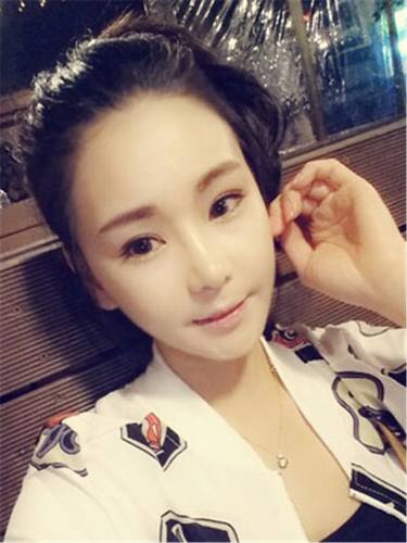 脂肪填充面部,让我再次体验了蜕变的感觉有多美妙!!!想要变美的女生看过来,给你们分享我的变美经历啦~~~~