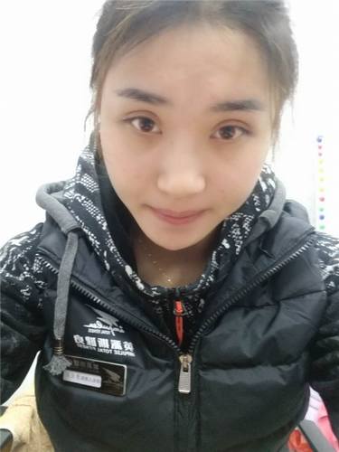 芜湖瑞丽翟奔宇自体脂肪丰太阳穴