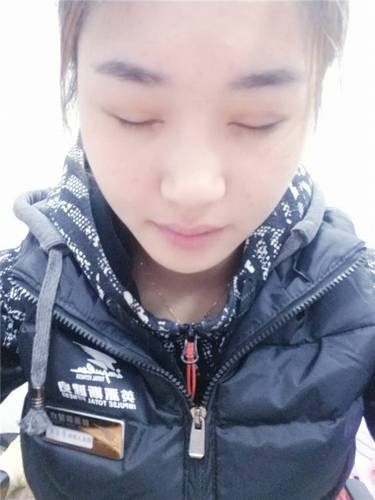 芜湖瑞丽翟奔宇自体脂肪丰太阳穴