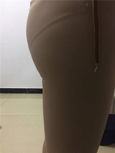 深圳雅唯吸脂瘦大腿