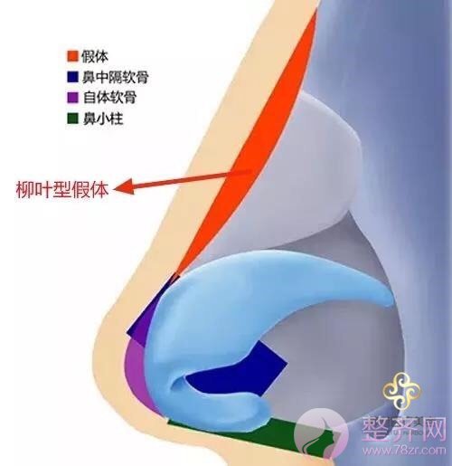 既然已经隆过鼻，为啥还要再做一次呢？