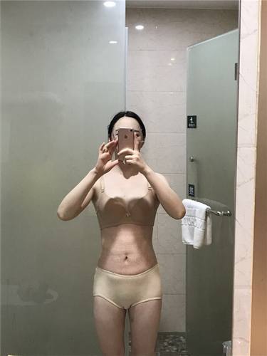 重庆好美罗海军吸脂瘦腹部