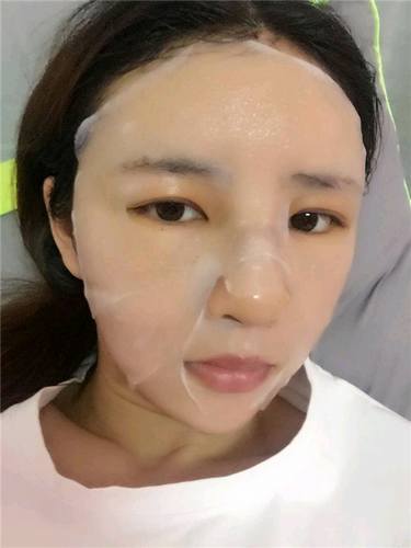 给姐妹们看看我的自体脂肪填充案例，过年再也不怕和朋友出去聚餐了！！变得美美的，大家可不要羡慕我哦，哈哈哈哈，下面给大家看看我的变美经历！哇咔咔，嘿嘿~~~~