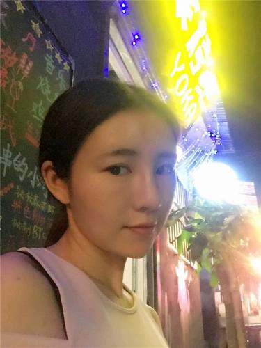 给姐妹们看看我的自体脂肪填充案例，过年再也不怕和朋友出去聚餐了！！变得美美的，大家可不要羡慕我哦，哈哈哈哈，下面给大家看看我的变美经历！哇咔咔，嘿嘿~~~~