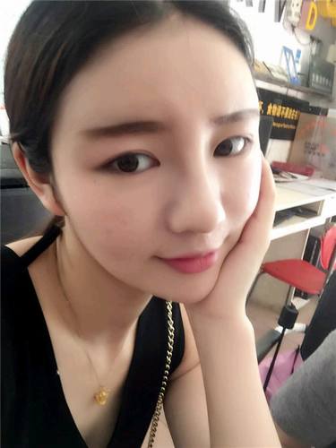 给姐妹们看看我的自体脂肪填充案例，过年再也不怕和朋友出去聚餐了！！变得美美的，大家可不要羡慕我哦，哈哈哈哈，下面给大家看看我的变美经历！哇咔咔，嘿嘿~~~~