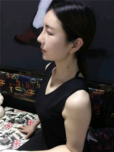 给姐妹们看看我的自体脂肪填充案例，过年再也不怕和朋友出去聚餐了！！变得美美的，大家可不要羡慕我哦，哈哈哈哈，下面给大家看看我的变美经历！哇咔咔，嘿嘿~~~~