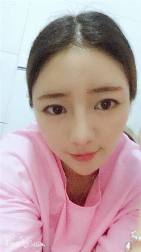 给姐妹们看看我的自体脂肪填充案例，过年再也不怕和朋友出去聚餐了！！变得美美的，大家可不要羡慕我哦，哈哈哈哈，下面给大家看看我的变美经历！哇咔咔，嘿嘿~~~~