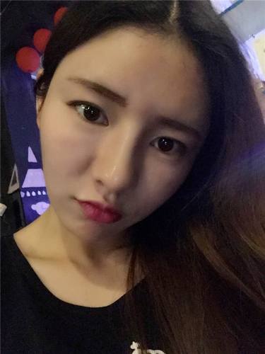 给姐妹们看看我的自体脂肪填充案例，过年再也不怕和朋友出去聚餐了！！变得美美的，大家可不要羡慕我哦，哈哈哈哈，下面给大家看看我的变美经历！哇咔咔，嘿嘿~~~~