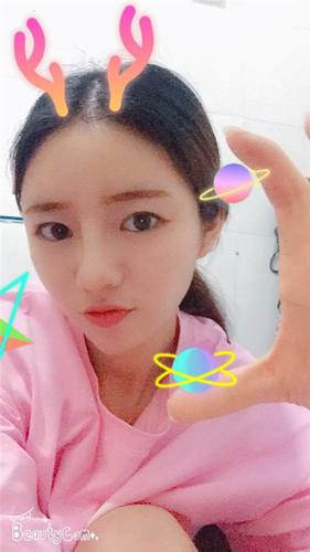 给姐妹们看看我的自体脂肪填充案例，过年再也不怕和朋友出去聚餐了！！变得美美的，大家可不要羡慕我哦，哈哈哈哈，下面给大家看看我的变美经历！哇咔咔，嘿嘿~~~~