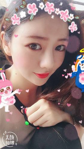 给姐妹们看看我的自体脂肪填充案例，过年再也不怕和朋友出去聚餐了！！变得美美的，大家可不要羡慕我哦，哈哈哈哈，下面给大家看看我的变美经历！哇咔咔，嘿嘿~~~~