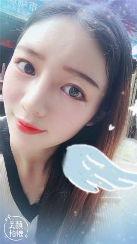 给姐妹们看看我的自体脂肪填充案例，过年再也不怕和朋友出去聚餐了！！变得美美的，大家可不要羡慕我哦，哈哈哈哈，下面给大家看看我的变美经历！哇咔咔，嘿嘿~~~~