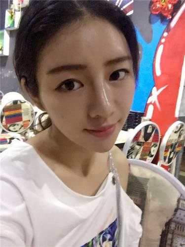 给姐妹们看看我的自体脂肪填充案例，过年再也不怕和朋友出去聚餐了！！变得美美的，大家可不要羡慕我哦，哈哈哈哈，下面给大家看看我的变美经历！哇咔咔，嘿嘿~~~~