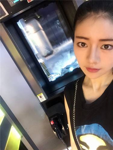 给姐妹们看看我的自体脂肪填充案例，过年再也不怕和朋友出去聚餐了！！变得美美的，大家可不要羡慕我哦，哈哈哈哈，下面给大家看看我的变美经历！哇咔咔，嘿嘿~~~~