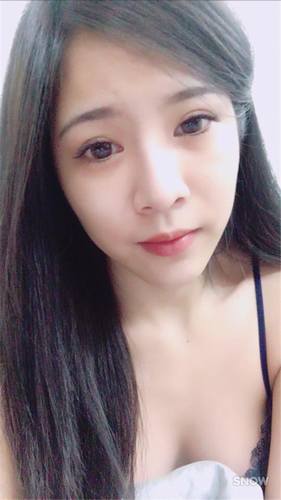 武汉化蝶吴明瑞自体脂肪脸部填充