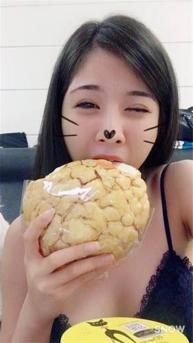 武汉化蝶吴明瑞自体脂肪脸部填充