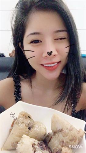 武汉化蝶吴明瑞自体脂肪脸部填充