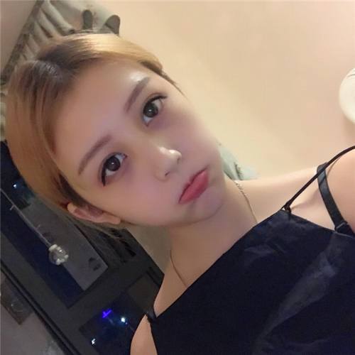 自体脂肪填充脸部后,网红都没有我这么美!!进来看看我的变美案例呦!不看后悔的是你呦