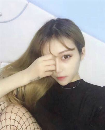 自体脂肪填充脸部后,网红都没有我这么美!!进来看看我的变美案例呦!不看后悔的是你呦