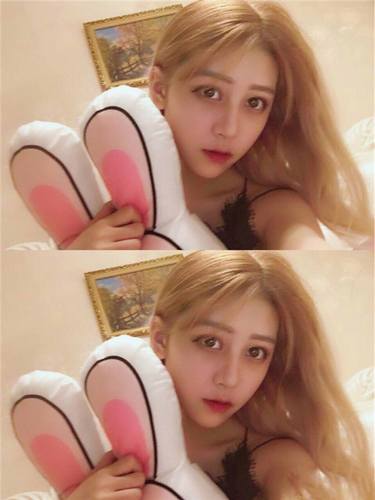 自体脂肪填充脸部后,网红都没有我这么美!!进来看看我的变美案例呦!不看后悔的是你呦