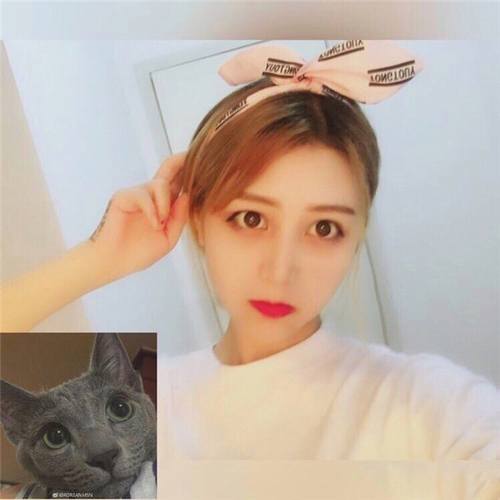 自体脂肪填充脸部后,网红都没有我这么美!!进来看看我的变美案例呦!不看后悔的是你呦