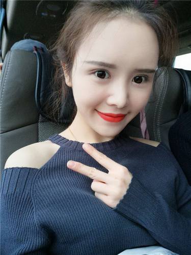 上海德琳唐玲自体脂肪填充脸部