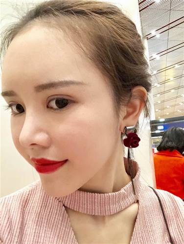 上海德琳唐玲自体脂肪填充脸部