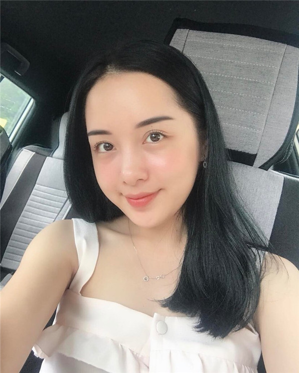 小姐姐们，进来看看我的神奇变美经历！自体脂肪丰太阳穴后脸部轮廓美的不行~~~~嗨嗨嗨拍照再也不用各种找角度了嘻嘻~~