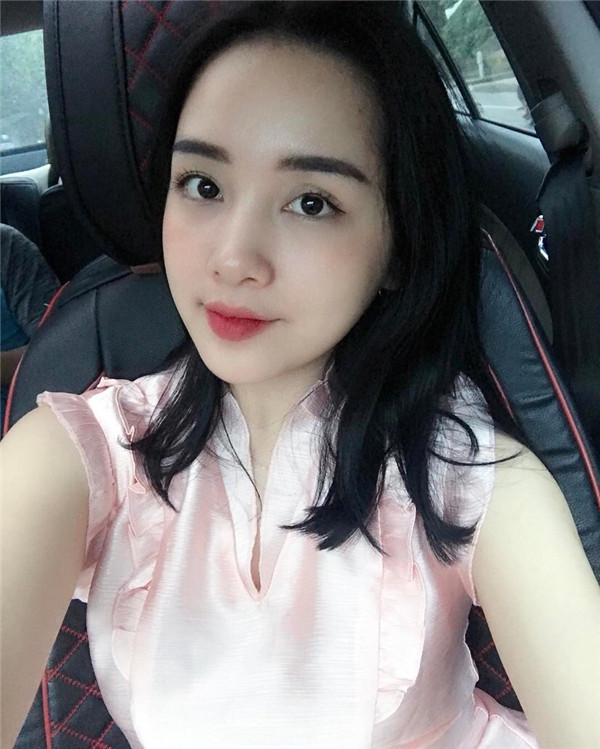 小姐姐们，进来看看我的神奇变美经历！自体脂肪丰太阳穴后脸部轮廓美的不行~~~~嗨嗨嗨拍照再也不用各种找角度了嘻嘻~~