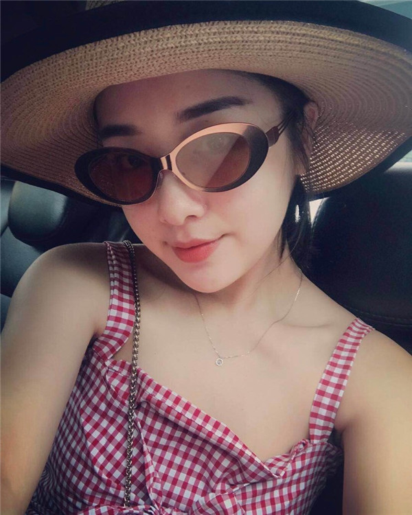 小姐姐们，进来看看我的神奇变美经历！自体脂肪丰太阳穴后脸部轮廓美的不行~~~~嗨嗨嗨拍照再也不用各种找角度了嘻嘻~~