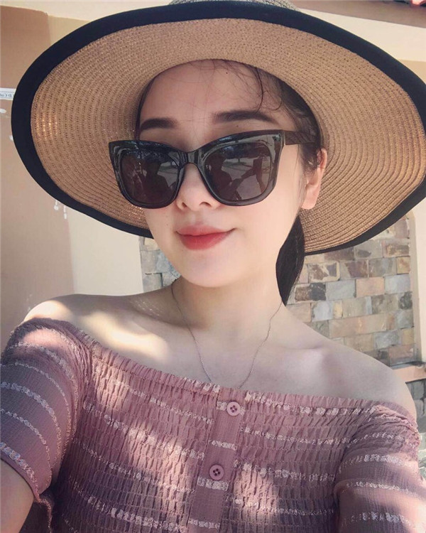 小姐姐们，进来看看我的神奇变美经历！自体脂肪丰太阳穴后脸部轮廓美的不行~~~~嗨嗨嗨拍照再也不用各种找角度了嘻嘻~~