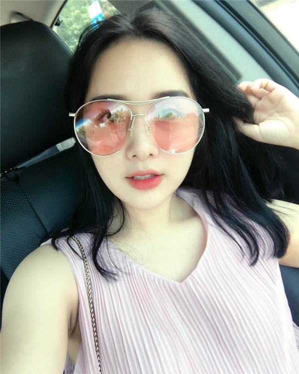 小姐姐们，进来看看我的神奇变美经历！自体脂肪丰太阳穴后脸部轮廓美的不行~~~~嗨嗨嗨拍照再也不用各种找角度了嘻嘻~~