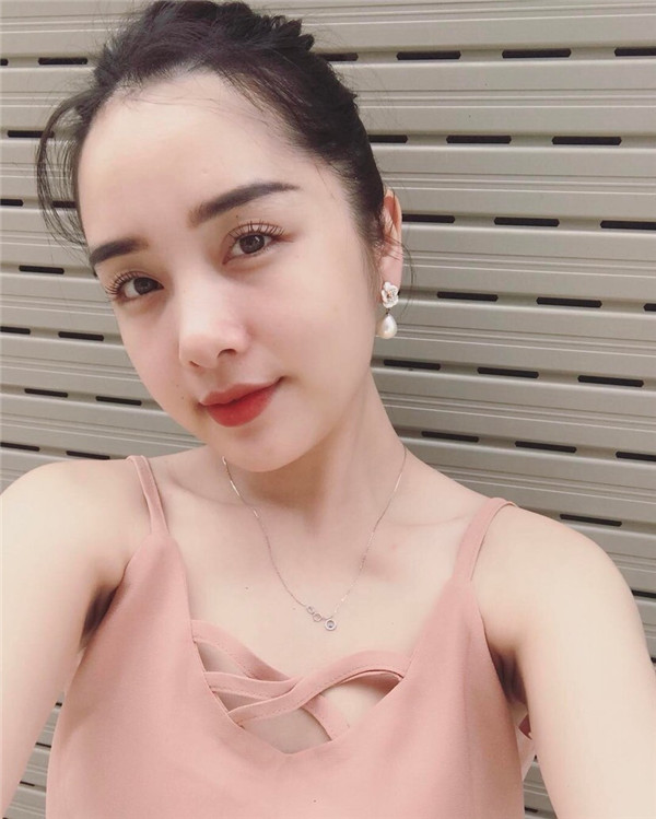 小姐姐们，进来看看我的神奇变美经历！自体脂肪丰太阳穴后脸部轮廓美的不行~~~~嗨嗨嗨拍照再也不用各种找角度了嘻嘻~~