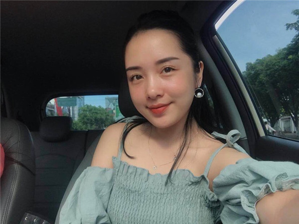 小姐姐们，进来看看我的神奇变美经历！自体脂肪丰太阳穴后脸部轮廓美的不行~~~~嗨嗨嗨拍照再也不用各种找角度了嘻嘻~~