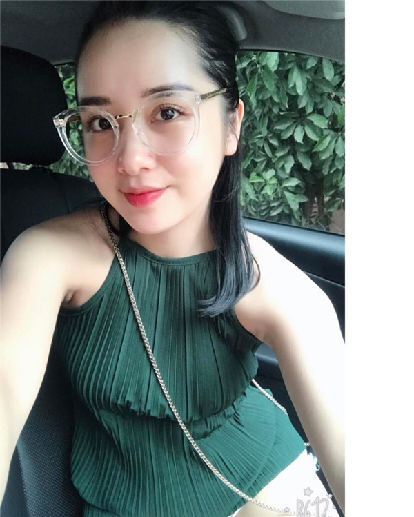 小姐姐们，进来看看我的神奇变美经历！自体脂肪丰太阳穴后脸部轮廓美的不行~~~~嗨嗨嗨拍照再也不用各种找角度了嘻嘻~~