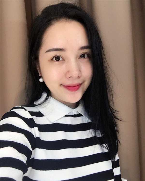 小姐姐们，进来看看我的神奇变美经历！自体脂肪丰太阳穴后脸部轮廓美的不行~~~~嗨嗨嗨拍照再也不用各种找角度了嘻嘻~~