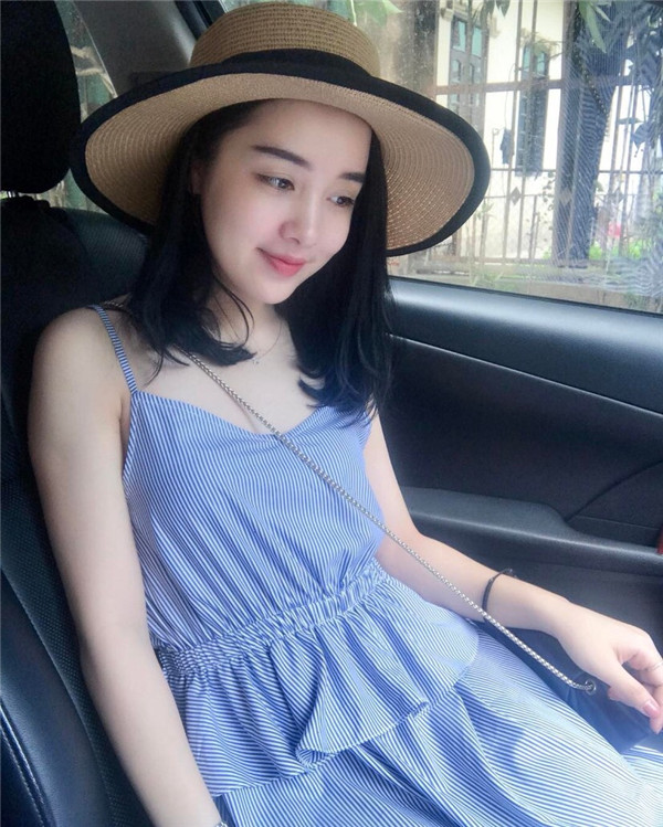 小姐姐们，进来看看我的神奇变美经历！自体脂肪丰太阳穴后脸部轮廓美的不行~~~~嗨嗨嗨拍照再也不用各种找角度了嘻嘻~~