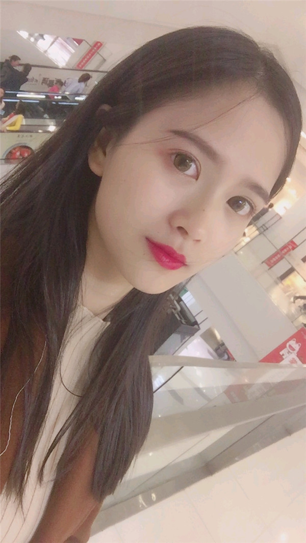 亲爱的宝宝们，我来给你们分享我的脂肪填充脸部的案例啦~~~ 我填充了哪里你们看出来了没？？？感觉现在就是我的颜值高级O(∩_∩)O哈哈~