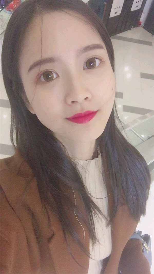 亲爱的宝宝们，我来给你们分享我的脂肪填充脸部的案例啦~~~ 我填充了哪里你们看出来了没？？？感觉现在就是我的颜值高级O(∩_∩)O哈哈~