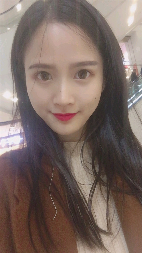 亲爱的宝宝们，我来给你们分享我的脂肪填充脸部的案例啦~~~ 我填充了哪里你们看出来了没？？？感觉现在就是我的颜值高级O(∩_∩)O哈哈~