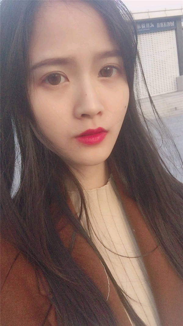 亲爱的宝宝们，我来给你们分享我的脂肪填充脸部的案例啦~~~ 我填充了哪里你们看出来了没？？？感觉现在就是我的颜值高级O(∩_∩)O哈哈~