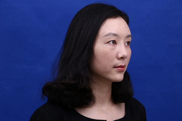 大家新年好呀!2018年我来给你们分享我的自体脂肪填充脸部案例啦~~素颜照、美照都有哦,嘻嘻(#^.^#)