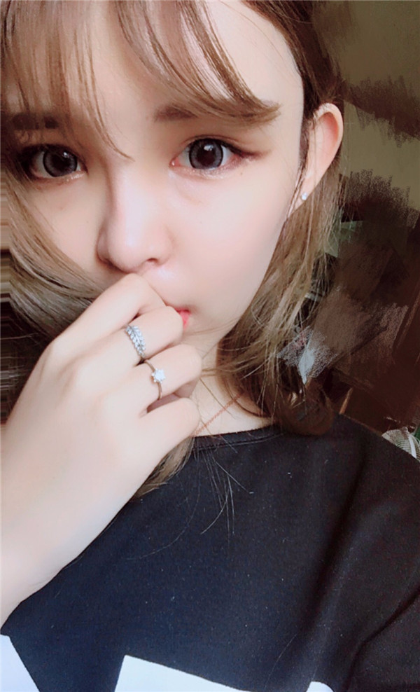 宝宝们，我去做了自体脂肪填充脸部，悄悄告诉你们，别人都看不出来我做了微整哈哈哈~~