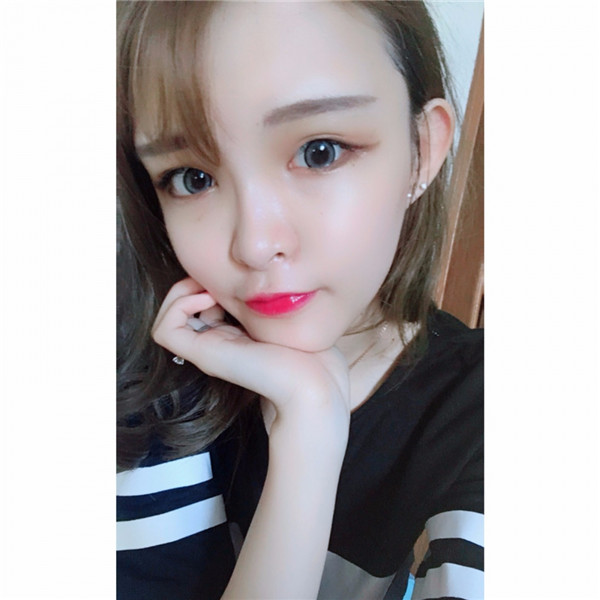 宝宝们，我去做了自体脂肪填充脸部，悄悄告诉你们，别人都看不出来我做了微整哈哈哈~~