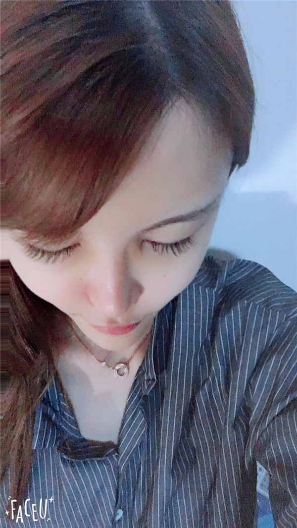 宝宝们，我去做了自体脂肪填充脸部，悄悄告诉你们，别人都看不出来我做了微整哈哈哈~~