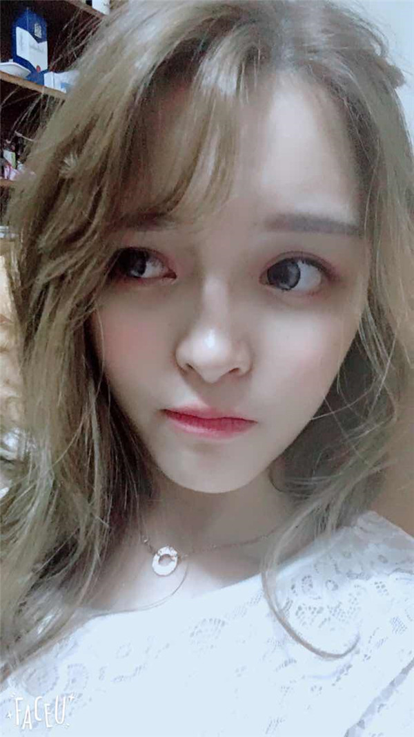 宝宝们，我去做了自体脂肪填充脸部，悄悄告诉你们，别人都看不出来我做了微整哈哈哈~~